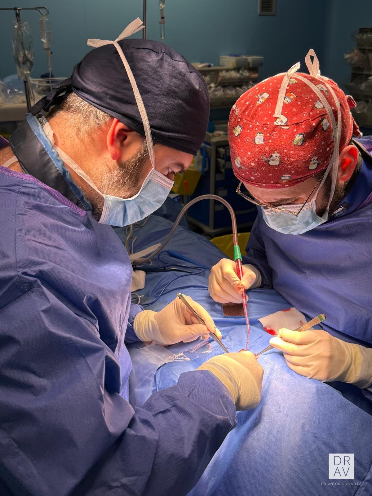 Microcirugía endoscópica biportal UBE/ESUBE de columna realizada por el Dr. Vilatela en Valencia